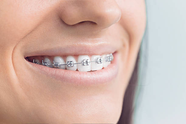 Full Mouth Reconstruction in Damascus, MD